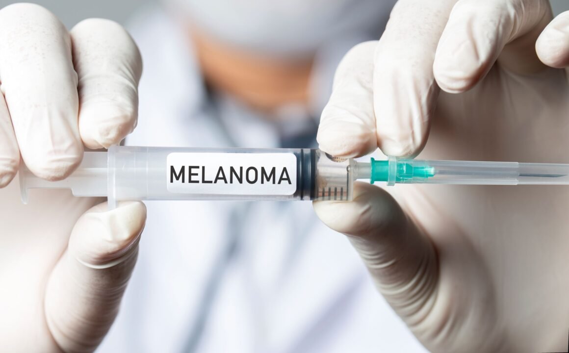 New mRNA Vaccine Reduces Risk of Melanoma Recurrence by Over 40 Percent